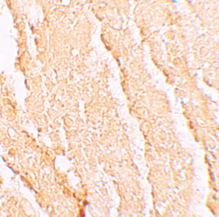 Immunohistochemistry of VPS39 in mouse liver tissue with VPS39 antibody at 5 μg/mL