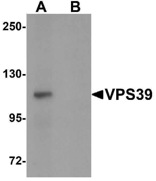 Western blot analysis of VPS39 in rat liver tissue lysate with VPS39 antibody at 0