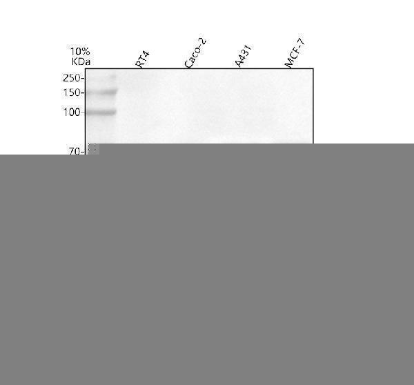  Western blot analysis of MARVELD2 using anti-MARVELD2 antibody (A05714-1)