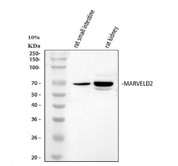  Western blot analysis of MARVELD2 using anti-MARVELD2 antibody (A05714-1)
