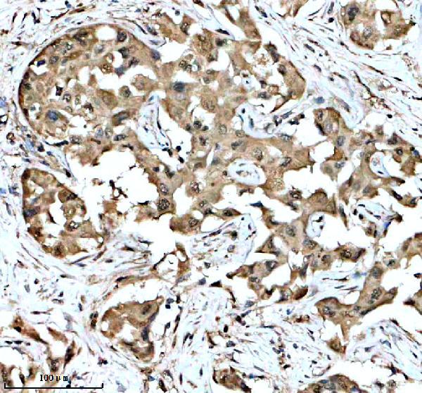 a05716 2 tnip2 primary antibodies ihc testing 1