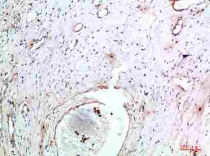 a05716 tnip2 primary antibodyes ihc testing 1