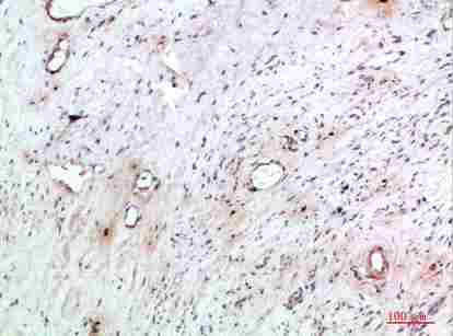a05716 tnip2 primary antibodyes ihc testing 2