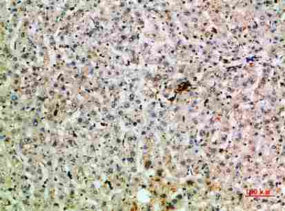 a05716 tnip2 primary antibodyes ihc testing 3