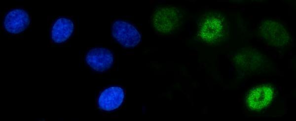 a05718 3 sycp3 primary antibodies if testing 5