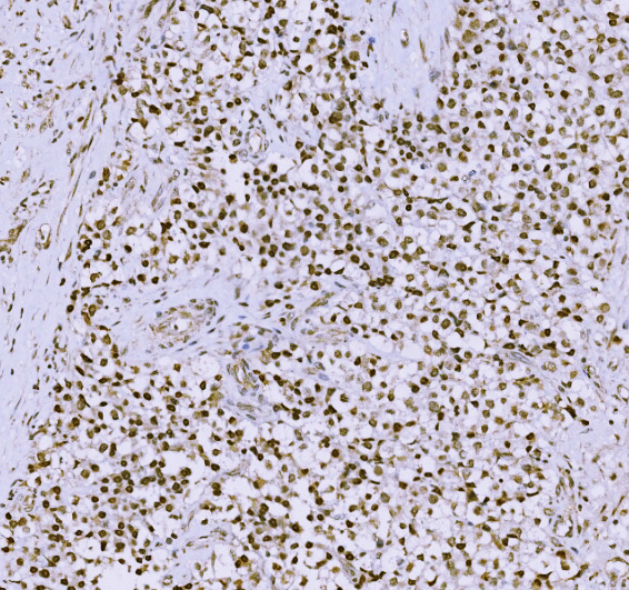  IHC analysis of SCP3/SYCP3 using anti-SCP3/SYCP3 antibody (A05718-3)