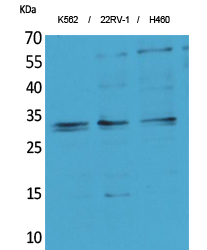 Western Blot analysis of K562, 22RV-1, H460 cells using SCP-3 Polyclonal Antibody