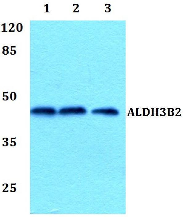 Western blot (WB) analysis of ALDH3B2 polyclonal antibody at 1:500 dilution
Lane1:Hela whole cell lysate
Lane2:Raw264