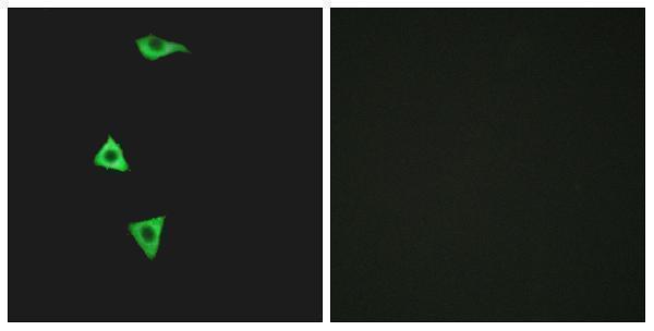 Immunofluorescence analysis of LOVO cells, using BDKRB1 Antibody