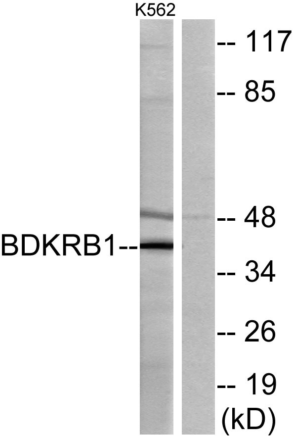 Western blot analysis of lysates from K562 cells, using BDKRB1 Antibody