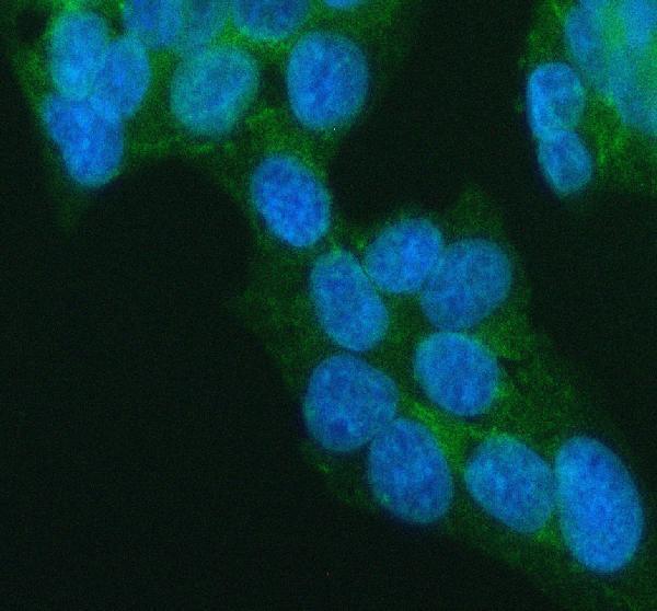 a05725 1 lpar6 primary antibodies if testing 1
