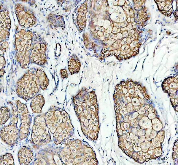 a05725 1 lpar6 primary antibodies ihc testing 1