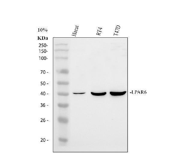 a05725 1 lpar6 primary antibodies wb testing 1