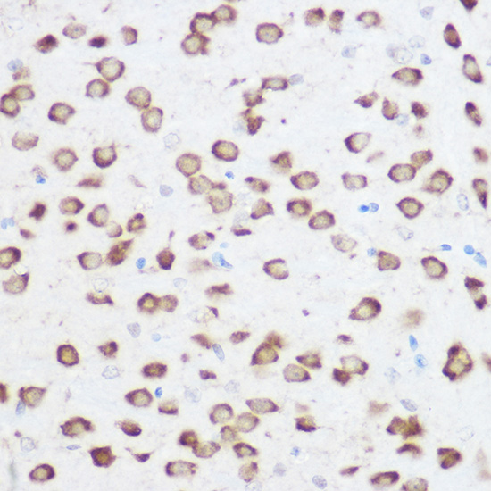 a05730 rps24 primary antiboties ihc testing 2