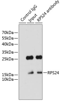 a05730 rps24 primary antiboties ip testing 3