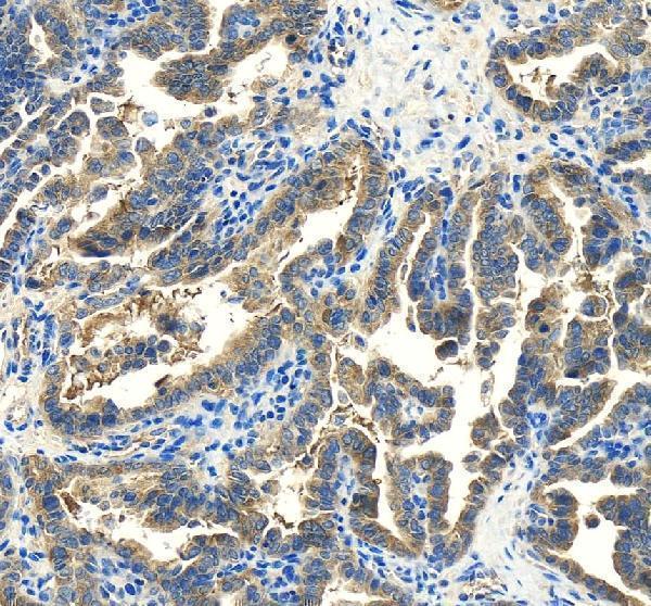 IHC analysis of PPM1B using anti-PPM1B antibody (A05731-1)