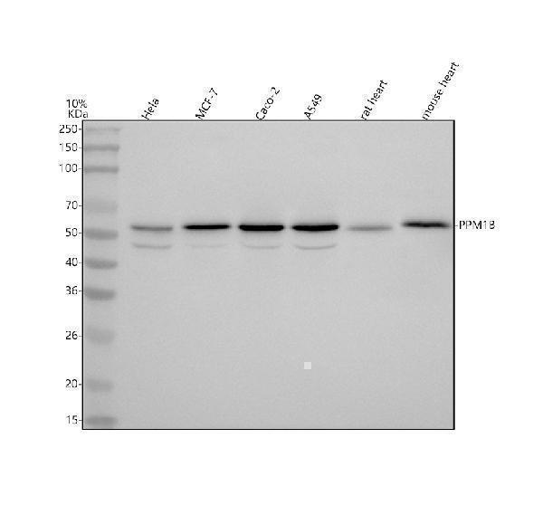  Western blot analysis of PPM1B using anti-PPM1B antibody (A05731-1)