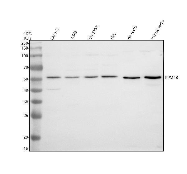 Western blot analysis of PPM1B using anti-PPM1B antibody (A05731-1)