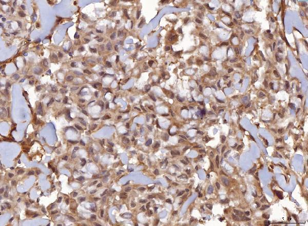  IHC analysis of AHA1/AHSA1 using anti-AHA1/AHSA1 antibody (A05733-2)
