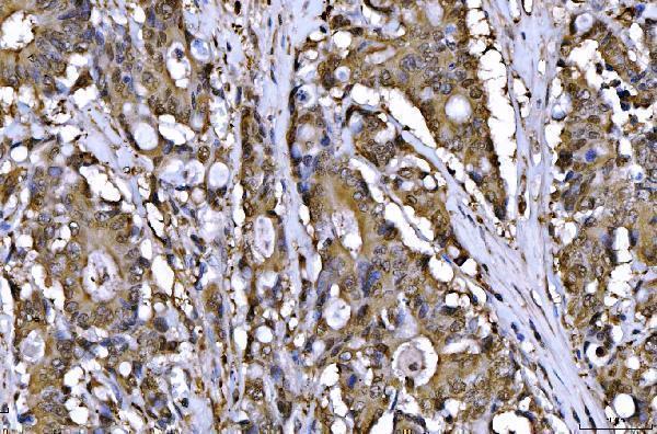  IHC analysis of AHA1/AHSA1 using anti-AHA1/AHSA1 antibody (A05733-2)