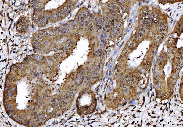 a05733 2 ahsa1 primary antibodies ihc testing 4