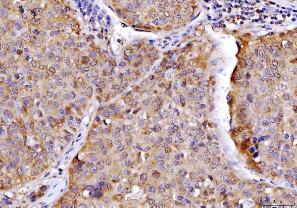 a05733 2 ahsa1 primary antibodies ihc testing 6