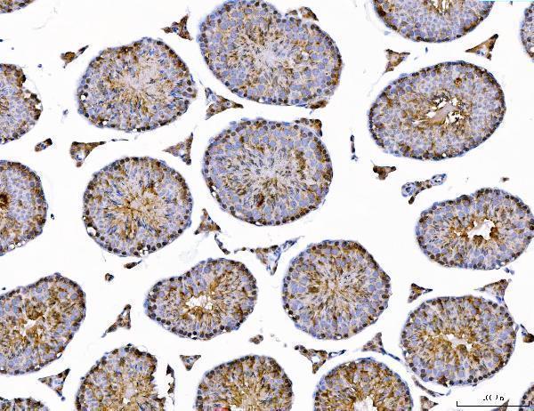 a05733 2 ahsa1 primary antibodies ihc testing 7