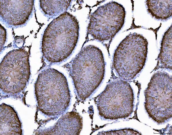 a05733 2 ahsa1 primary antibodies ihc testing 8