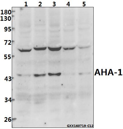 Western blot (WB) analysis of AHA-1 (T183) polyclonal antibody at 1:500 dilution
Lane1:L02 whole cell lysate(40ug)
Lane2:HEK293T whole cell lysate(40ug)
Lane3:786-O whole cell lysate(40ug)
Lane4:HepG2 whole cell lysate(40ug)
Lane5:U87-MG whole cell lysate(40ug)