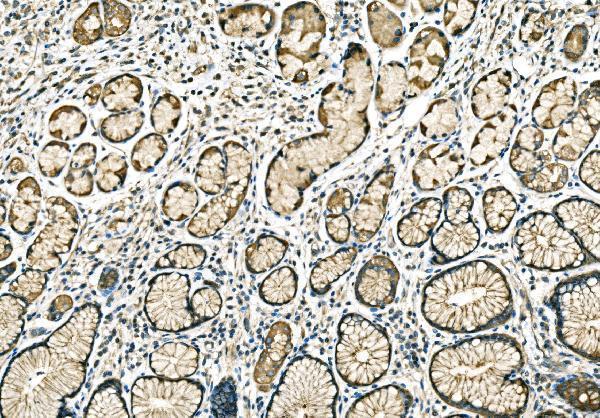  IHC analysis of PPFIA1 using anti-PPFIA1 antibody (A05735-1)