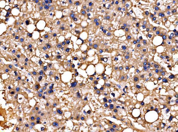  IHC analysis of PPFIA1 using anti-PPFIA1 antibody (A05735-1)