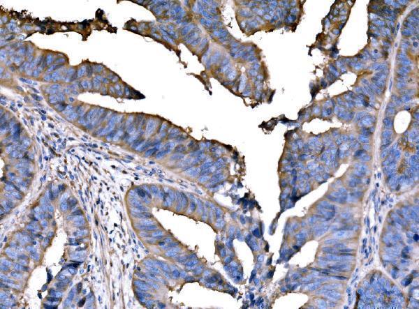 a05735 1 pppfia1 primary antibodies ihc testing 4