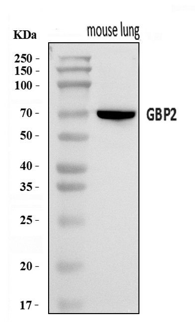  Western blot analysis of Gbp2 using anti-Gbp2 antibody (A05737-2)
