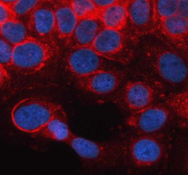 a05737 3 gbp2 primary antibodies if testing 1