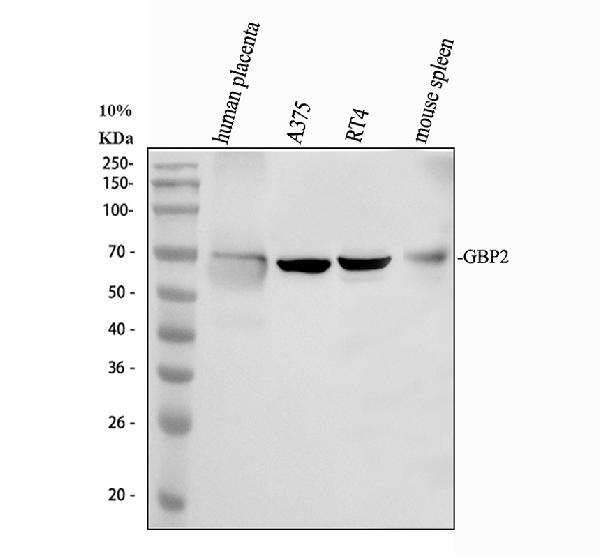 a05737 3 gbp2 primary antibodies wb testing 1