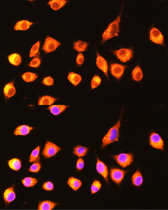 Immunofluorescence analysis of L929 cells using GBP2 Rabbit pAb  at dilution of 1:100 