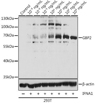 Western blot analysis of extracts of 293T cells, using GBP2 antibody  at 1:1000 dilution