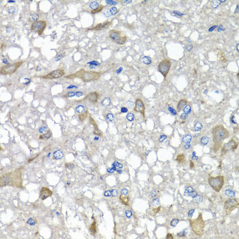Immunohistochemistry of paraffin-embedded rat brain using C1GALT1C1 antibody at dilution of 1:100 (x40 lens)