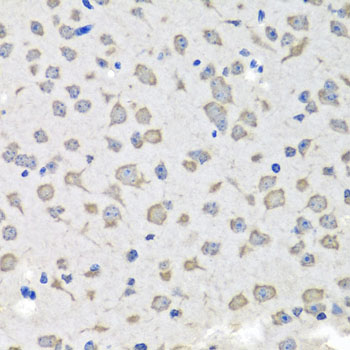 Immunohistochemistry of paraffin-embedded mouse brain using C1GALT1C1 antibody at dilution of 1:100 (x40 lens)