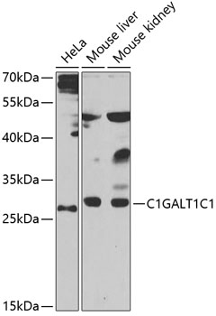 Western blot analysis of extracts of various cells, using C1GALT1C1 antibody
