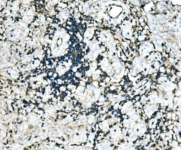 a05743 1 mef2b primary antibodies ihc testing 2