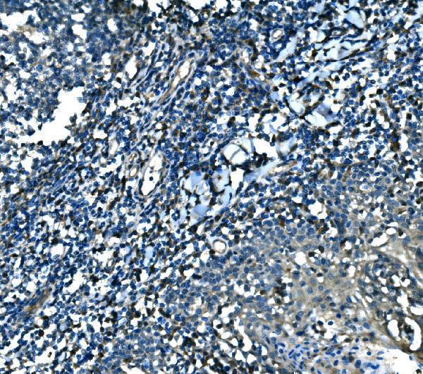 a05743 1 mef2b primary antibodies ihc testing 3