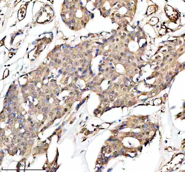  IHC analysis of PUF60 using anti-PUF60 antibody (A05744-2)