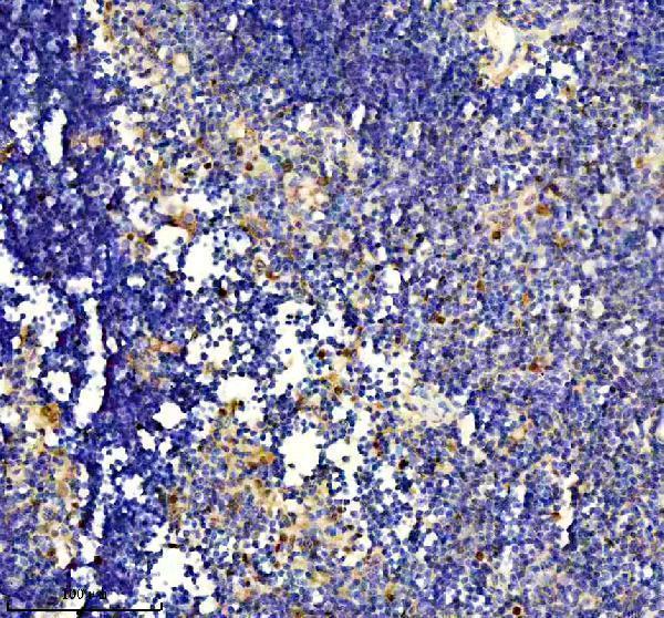  IHC analysis of PUF60 using anti-PUF60 antibody (A05744-2)