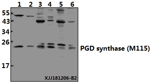 Western blot (WB) analysis of PGD synthase (M115) polyclonal antibody at 1:500 dilution
Lane1:SK-OVCAR3 whole cell lysate(40ug)
Lane2:U-87MG whole cell lysate(40ug)
Lane3:MCF-7 whole cell lysate(40ug)
Lane4:HepG2 whole cell lysate(40ug)
Lane5:C6 whole cell lysate(40ug)
Lane6:BV2 whole cell lysate(40ug)
