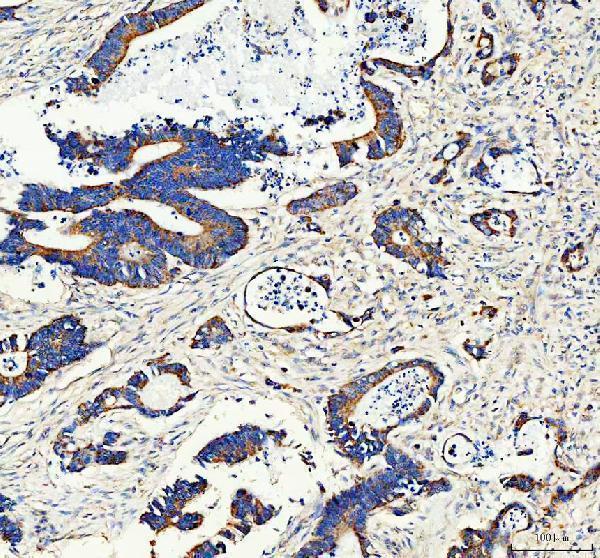 IHC analysis of ANGPTL2 using anti-ANGPTL2 antibody (A05747-1)