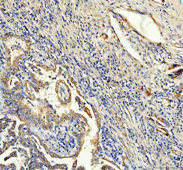 IHC analysis of ANGPTL2 using anti-ANGPTL2 antibody (A05747-1)
