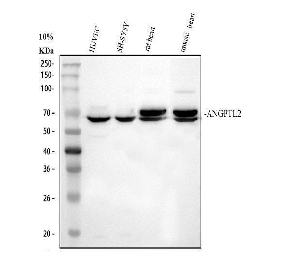 Western blot analysis of ANGPTL2 using anti-ANGPTL2 antibody (A05747-1)