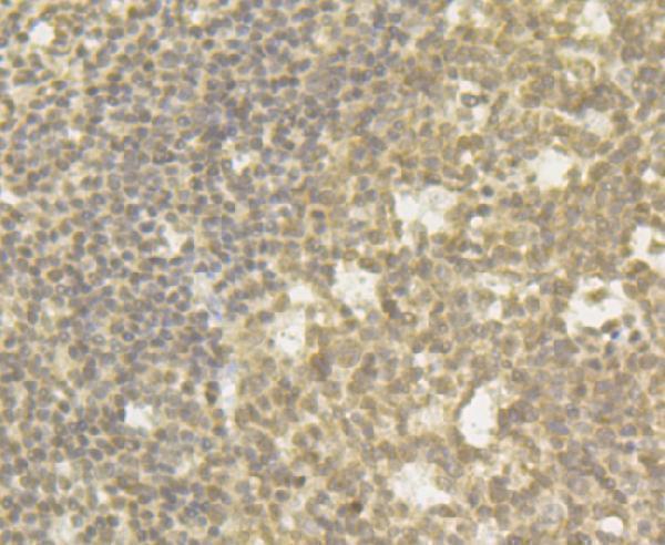 Immunohistochemical analysis of paraffin-embedded human tonsil tissue using anti-CHD1L antibody