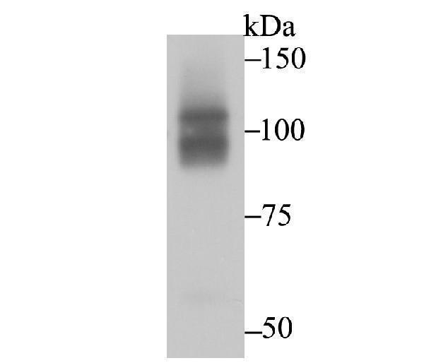 Western blot analysis of CHD1L on HepG2 cell using anti-CHD1L antibody at 1/1,000 dilution